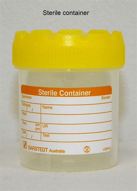 yellow top sample bottle